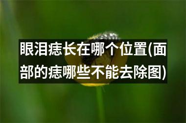 眼泪痣长在哪个位置(面部的痣哪些不能去除图)