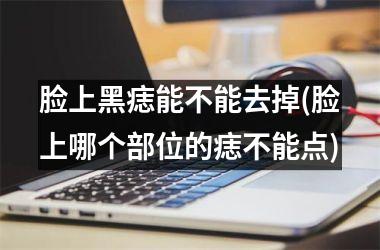 脸上黑痣能不能去掉(脸上哪个部位的痣不能点)