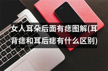 女人耳朵后面有痣图解(耳背痣和耳后痣有什么区别)