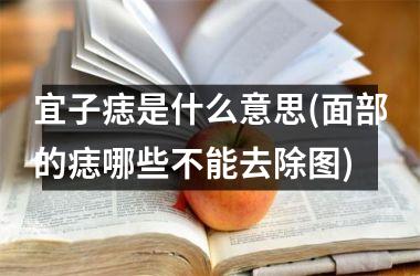 宜子痣是什么意思(面部的痣哪些不能去除图)
