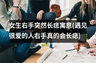 <h3>女生右手突然长痣寓意(遇见很爱的人右手真的会长痣)