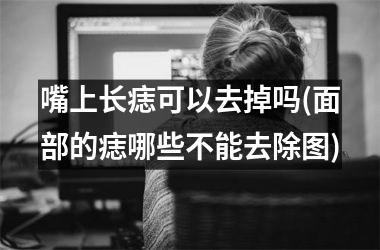 嘴上长痣可以去掉吗(面部的痣哪些不能去除图)