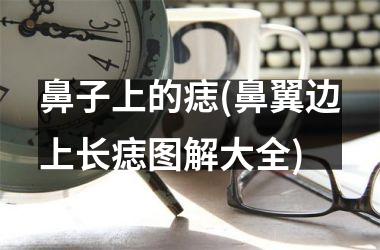 <h3>鼻子上的痣(鼻翼边上长痣图解大全)