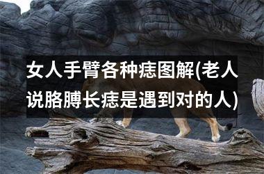 女人手臂各种痣图解(老人说胳膊长痣是遇到对的人)