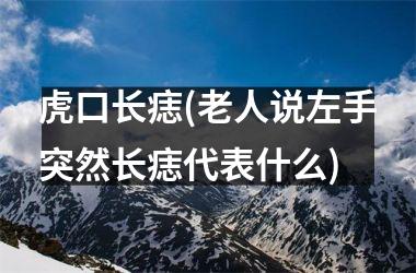 <h3>虎口长痣(老人说左手突然长痣代表什么)