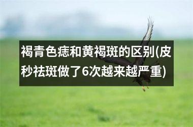 褐青色痣和黄褐斑的区别(皮秒祛斑做了6次越来越严重)