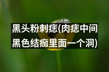 黑头粉刺痣(肉痣中间黑色结痂里面一个洞)
