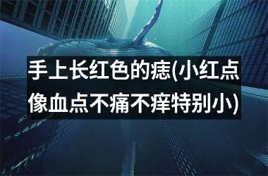 手上长红色的痣(小红点像血点不痛不痒特别小)