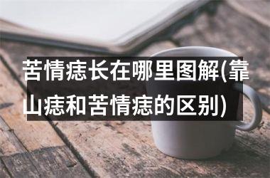 苦情痣长在哪里图解(靠山痣和苦情痣的区别)