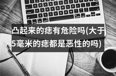 凸起来的痣有危险吗(大于5毫米的痣都是恶性的吗)