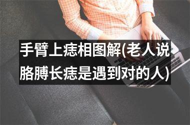 手臂上痣相图解(老人说胳膊长痣是遇到对的人)