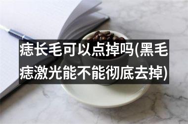 <h3>痣长毛可以点掉吗(黑毛痣激光能不能彻底去掉)