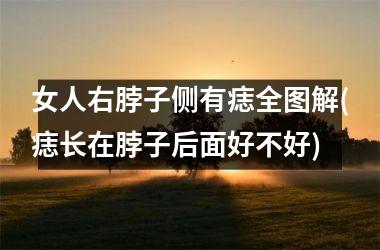 <h3>女人右脖子侧有痣全图解(痣长在脖子后面好不好)
