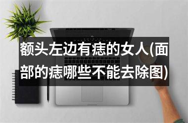 额头左边有痣的女人(面部的痣哪些不能去除图)