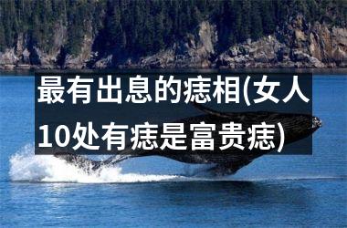 <h3>最有出息的痣相(女人10处有痣是富贵痣)