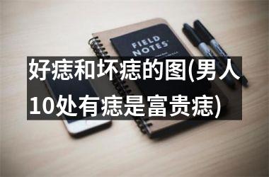 好痣和坏痣的图(男人10处有痣是富贵痣)