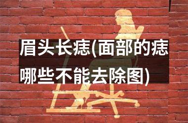 眉头长痣(面部的痣哪些不能去除图)