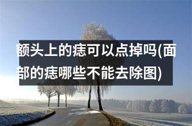 额头上的痣可以点掉吗(面部的痣哪些不能去除图)