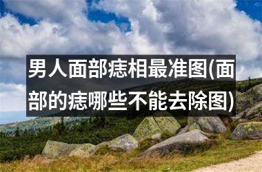 男人面部痣相最准图(面部的痣哪些不能去除图)