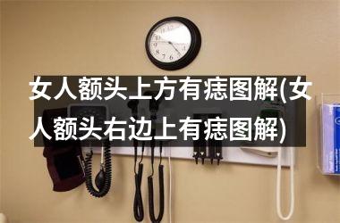 女人额头上方有痣图解(女人额头右边上有痣图解)