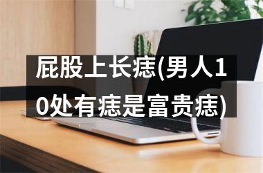 屁股上长痣(男人10处有痣是富贵痣)