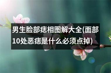 <h3>男生脸部痣相图解大全(面部10处恶痣是什么必须点掉)