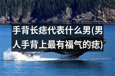 <h3>手背长痣代表什么男(男人手背上最有福气的痣)