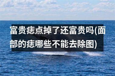 <h3>富贵痣点掉了还富贵吗(面部的痣哪些不能去除图)