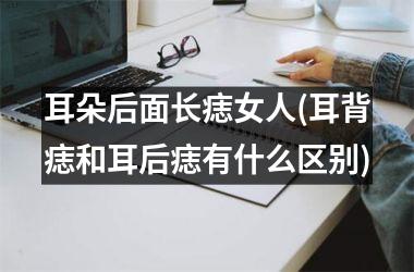 <h3>耳朵后面长痣女人(耳背痣和耳后痣有什么区别)