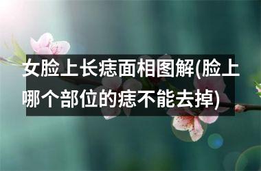 女脸上长痣面相图解(脸上哪个部位的痣不能去掉)