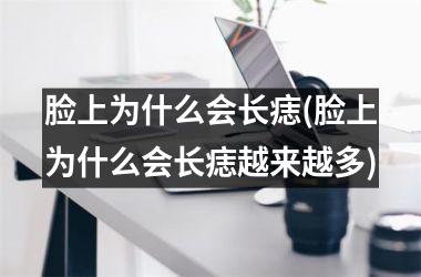 <h3>脸上为什么会长痣(脸上为什么会长痣越来越多)