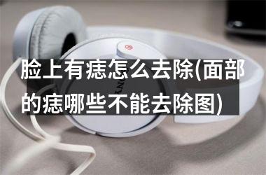 <h3>脸上有痣怎么去除(面部的痣哪些不能去除图)
