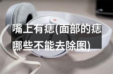 嘴上有痣(面部的痣哪些不能去除图)