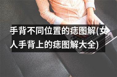 手背不同位置的痣图解(女人手背上的痣图解大全)