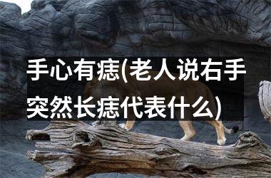 <h3>手心有痣(老人说右手突然长痣代表什么)