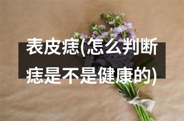 表皮痣(怎么判断痣是不是健康的)