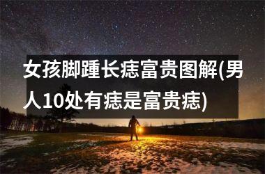 <h3>女孩脚踵长痣富贵图解(男人10处有痣是富贵痣)