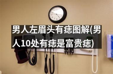 <h3>男人左眉头有痣图解(男人10处有痣是富贵痣)