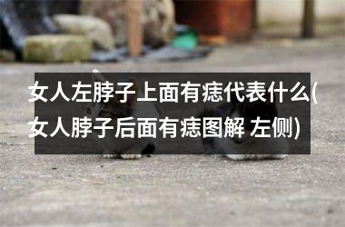 女人左脖子上面有痣代表什么(女人脖子后面有痣图解 左侧)