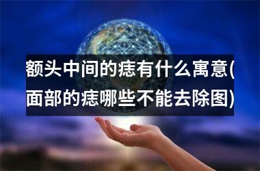 <h3>额头中间的痣有什么寓意(面部的痣哪些不能去除图)