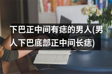 <h3>下巴正中间有痣的男人(男人下巴底部正中间长痣)