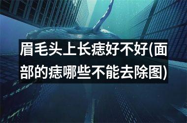 眉毛头上长痣好不好(面部的痣哪些不能去除图)