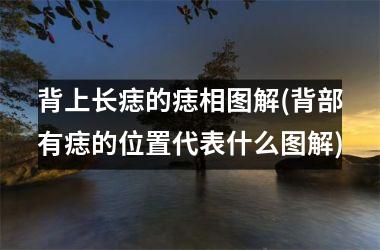 <h3>背上长痣的痣相图解(背部有痣的位置代表什么图解)