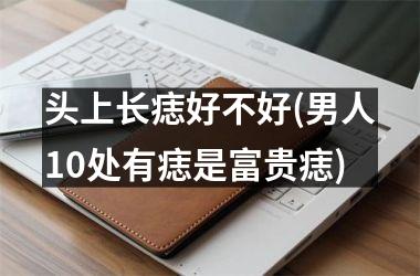 头上长痣好不好(男人10处有痣是富贵痣)