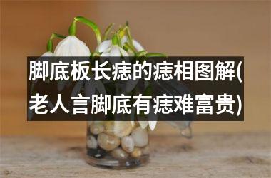 脚底板长痣的痣相图解(老人言脚底有痣难富贵)