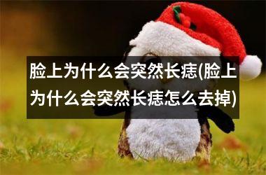 <h3>脸上为什么会突然长痣(脸上为什么会突然长痣怎么去掉)