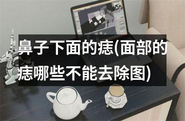 鼻子下面的痣(面部的痣哪些不能去除图)