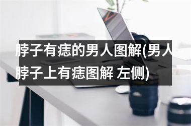 脖子有痣的男人图解(男人脖子上有痣图解 左侧)