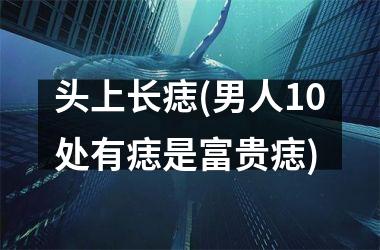 头上长痣(男人10处有痣是富贵痣)
