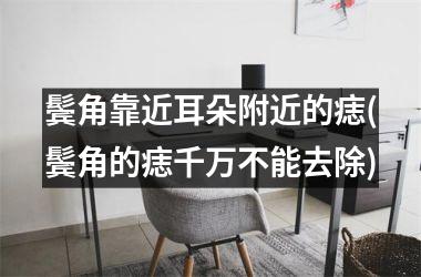 鬓角靠近耳朵附近的痣(鬓角的痣千万不能去除)